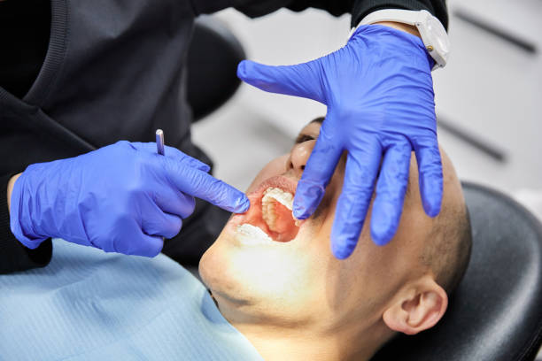 Best Emergency Root Canal Treatment in Glenville, CT