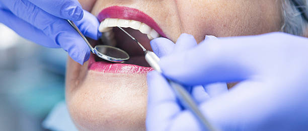Best Emergency Dental Care for Broken or Chipped Teeth in Glenville, CT
